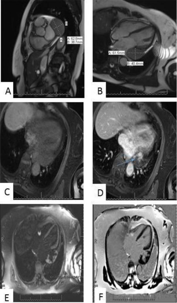 https://cdn.ncbi.nlm.nih.gov/pmc/blobs/6f53/6302030/9759e91ca155/gr2.jpg