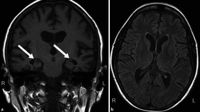 https://cdn.ncbi.nlm.nih.gov/pmc/blobs/6f5a/7809002/5e4f94c3e127/115_2020_922_Fig4_HTML.jpg