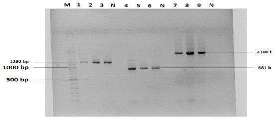 https://cdn.ncbi.nlm.nih.gov/pmc/blobs/6f5e/4385168/8b386605c103/IJM-5-402f1.jpg