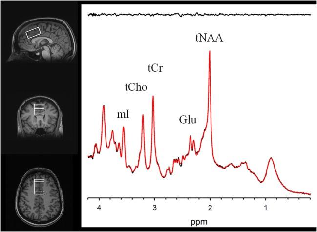 https://cdn.ncbi.nlm.nih.gov/pmc/blobs/6f61/5474459/a3032f17ac0d/fpsyt-08-00104-g001.jpg