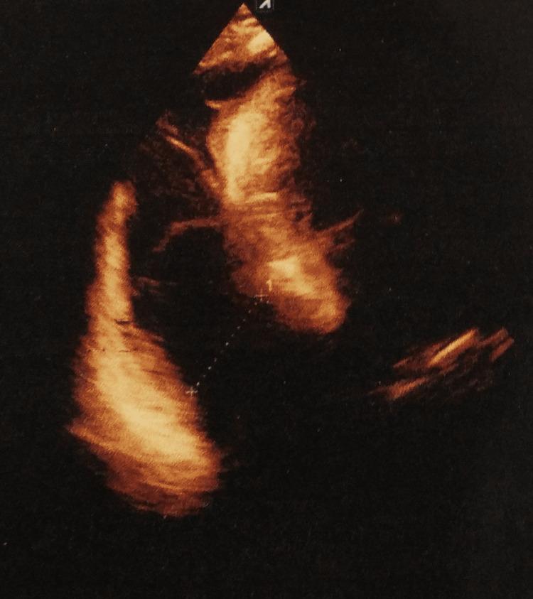 https://cdn.ncbi.nlm.nih.gov/pmc/blobs/6f6b/11144592/21ddc94c0803/cureus-0016-00000059546-i02.jpg
