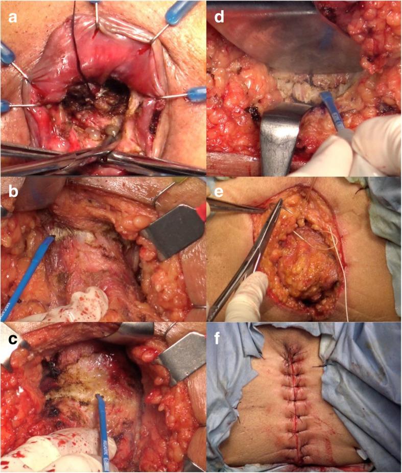 https://cdn.ncbi.nlm.nih.gov/pmc/blobs/6f74/6998343/6c4c41248a48/12893_2020_683_Fig2_HTML.jpg