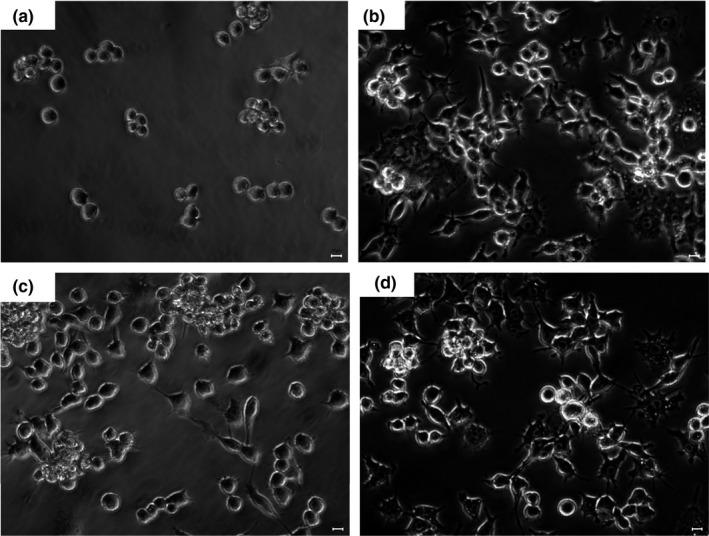 https://cdn.ncbi.nlm.nih.gov/pmc/blobs/6f79/9007286/4a5aa167950f/FSN3-10-1093-g001.jpg
