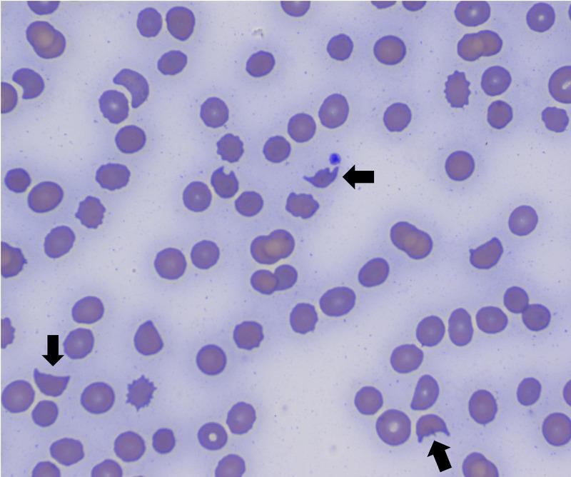 https://cdn.ncbi.nlm.nih.gov/pmc/blobs/6f81/7931775/9990ccdc960f/cureus-0013-00000013031-i02.jpg