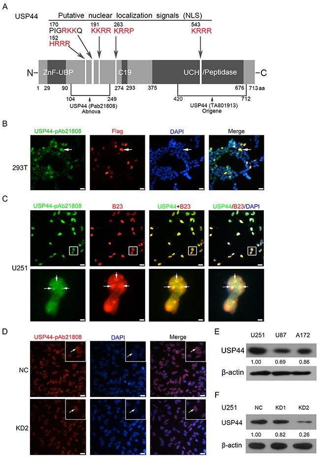 https://cdn.ncbi.nlm.nih.gov/pmc/blobs/6f82/5601647/6f62800fd7de/oncotarget-08-58231-g001.jpg