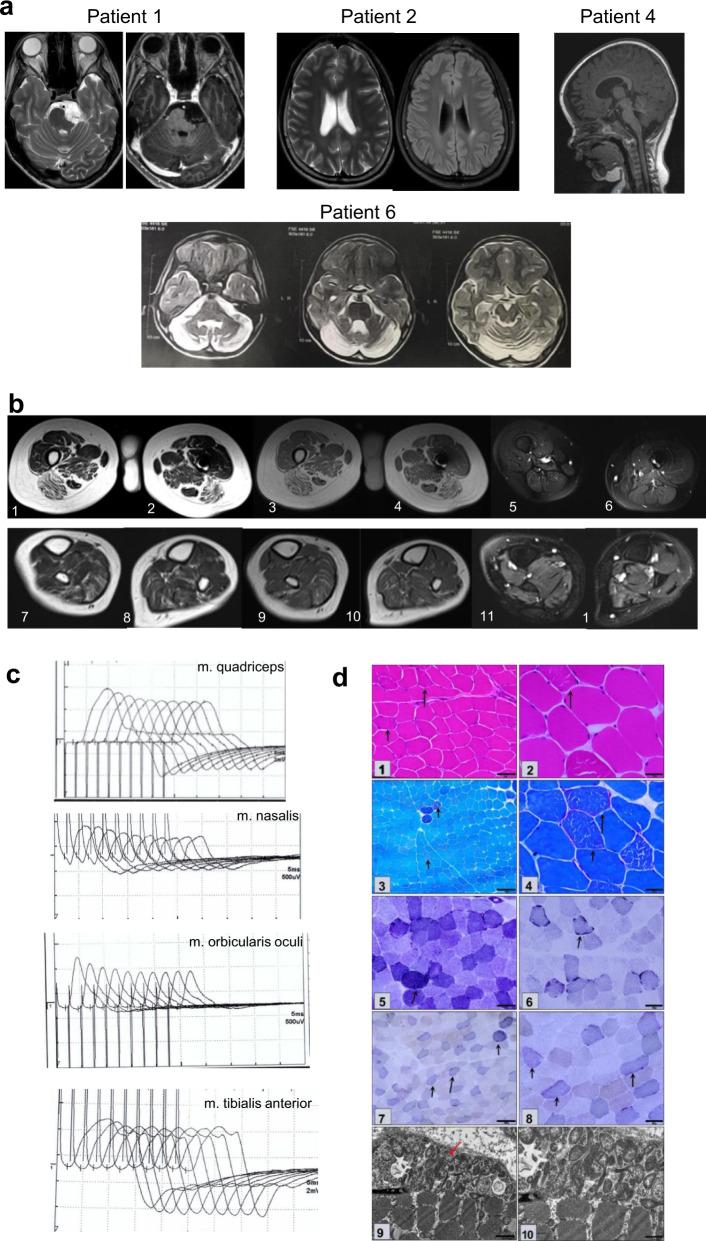 https://cdn.ncbi.nlm.nih.gov/pmc/blobs/6f85/9950373/a960609d2403/41467_2023_36277_Fig2_HTML.jpg