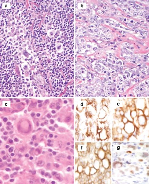 https://cdn.ncbi.nlm.nih.gov/pmc/blobs/6f8a/2798939/4b47903f2a56/12308_2009_53_Fig3_HTML.jpg
