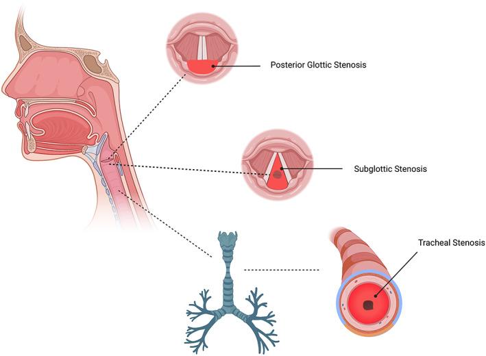 https://cdn.ncbi.nlm.nih.gov/pmc/blobs/6f8b/9543412/5f2e773dbe9b/HED-44-1948-g001.jpg