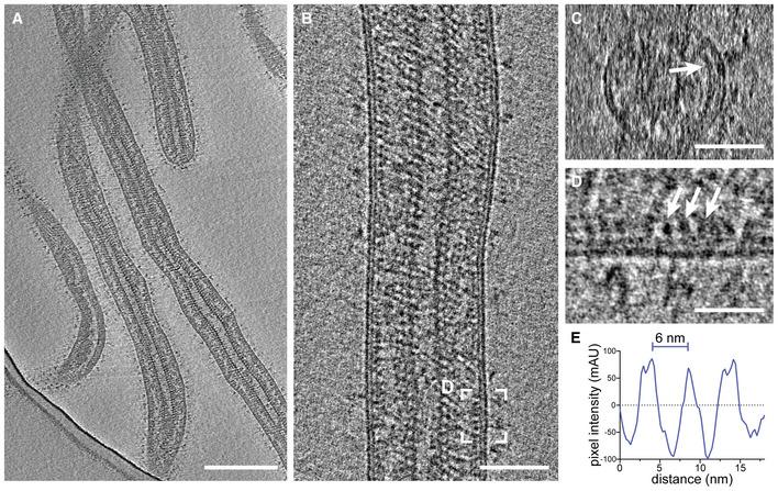 https://cdn.ncbi.nlm.nih.gov/pmc/blobs/6f90/10233383/84e8001a8914/EMBJ-42-e113578-g012.jpg