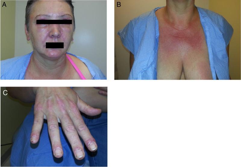 https://cdn.ncbi.nlm.nih.gov/pmc/blobs/6f90/4495251/7abc6135be45/rjv07505.jpg