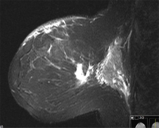 https://cdn.ncbi.nlm.nih.gov/pmc/blobs/6f90/4495251/f860e5eee10a/rjv07503.jpg