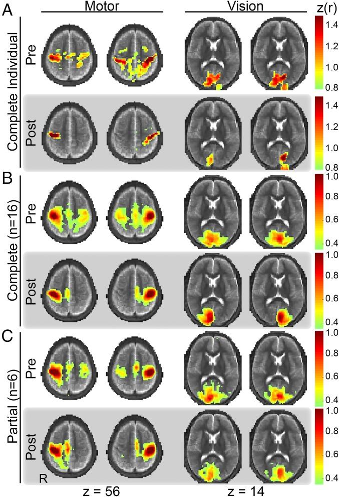 https://cdn.ncbi.nlm.nih.gov/pmc/blobs/6f94/5740665/9ee5cdd9d3c4/pnas.1707050114fig02.jpg
