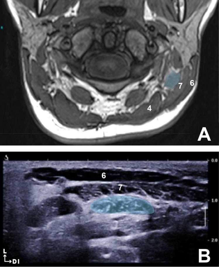https://cdn.ncbi.nlm.nih.gov/pmc/blobs/6f94/8164608/7dee74d442e2/276_2020_2646_Fig2_HTML.jpg
