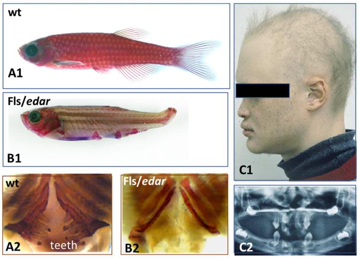https://cdn.ncbi.nlm.nih.gov/pmc/blobs/6f9a/10299021/4c93d17437a0/jdb-11-00025-g006.jpg