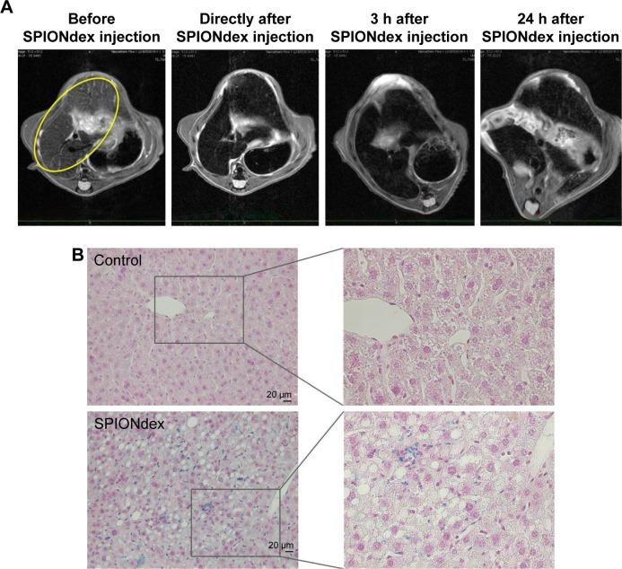 https://cdn.ncbi.nlm.nih.gov/pmc/blobs/6fa5/5533574/d40f0d3ae5d5/ijn-12-5223Fig6.jpg
