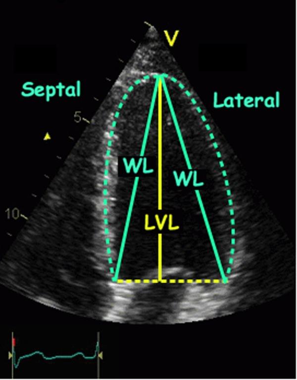 https://cdn.ncbi.nlm.nih.gov/pmc/blobs/6fa6/5051511/d27ec01c3b31/openhrt2016000465f01.jpg