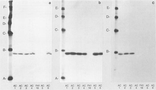 https://cdn.ncbi.nlm.nih.gov/pmc/blobs/6fae/258737/efc4682a3566/iai00054-0398-a.jpg