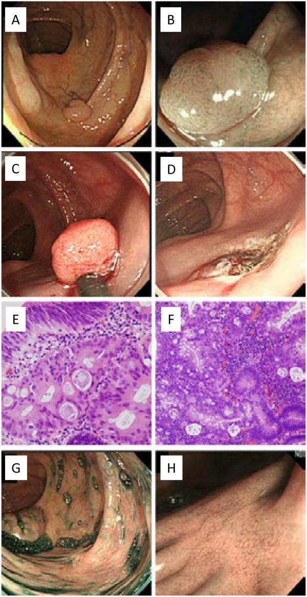 https://cdn.ncbi.nlm.nih.gov/pmc/blobs/6fb0/3937238/7959f06ab691/1746-1596-8-203-2.jpg