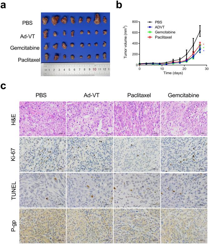 https://cdn.ncbi.nlm.nih.gov/pmc/blobs/6fb0/8993744/a3e66803f4b2/10637_2021_1204_Fig6_HTML.jpg