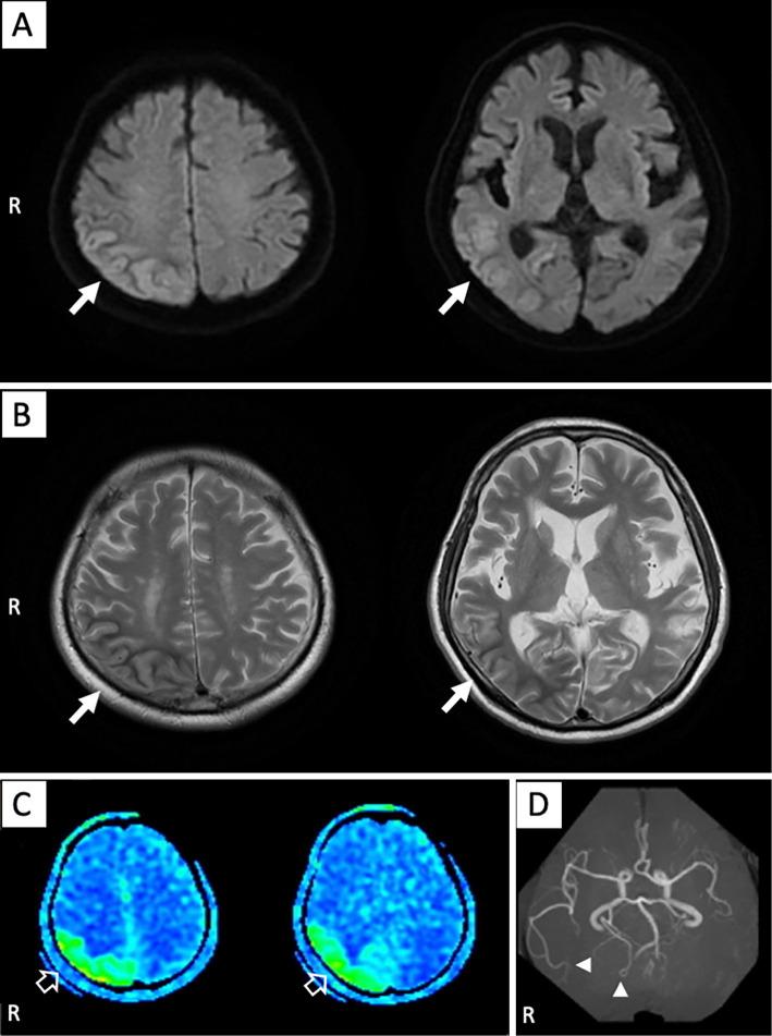 https://cdn.ncbi.nlm.nih.gov/pmc/blobs/6fb5/8545641/2641339d2f4c/1349-7235-60-3161-g001.jpg