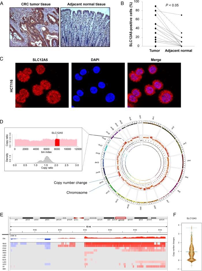 https://cdn.ncbi.nlm.nih.gov/pmc/blobs/6fbc/4819609/6d1507452a24/gutjnl-2014-308257f01.jpg