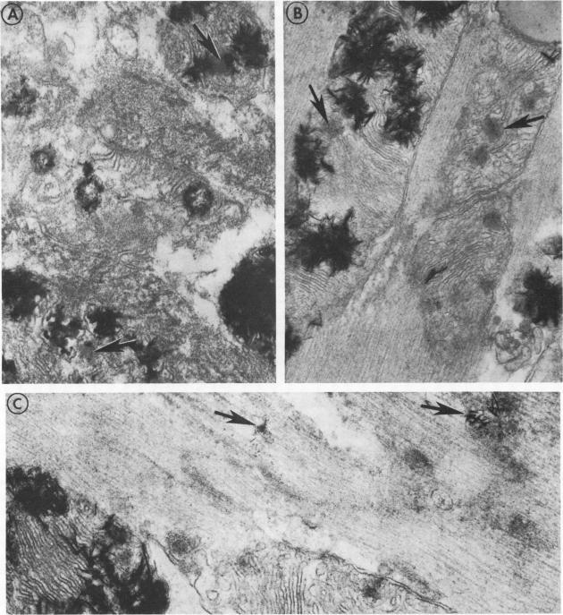 https://cdn.ncbi.nlm.nih.gov/pmc/blobs/6fbd/372418/ce3ff40404c5/jcinvest00657-0231-a.jpg