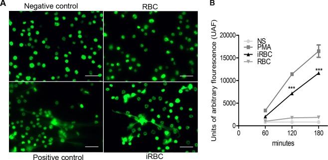 https://cdn.ncbi.nlm.nih.gov/pmc/blobs/6fbd/5142790/6cc5771696f6/ppat.1006054.g006.jpg