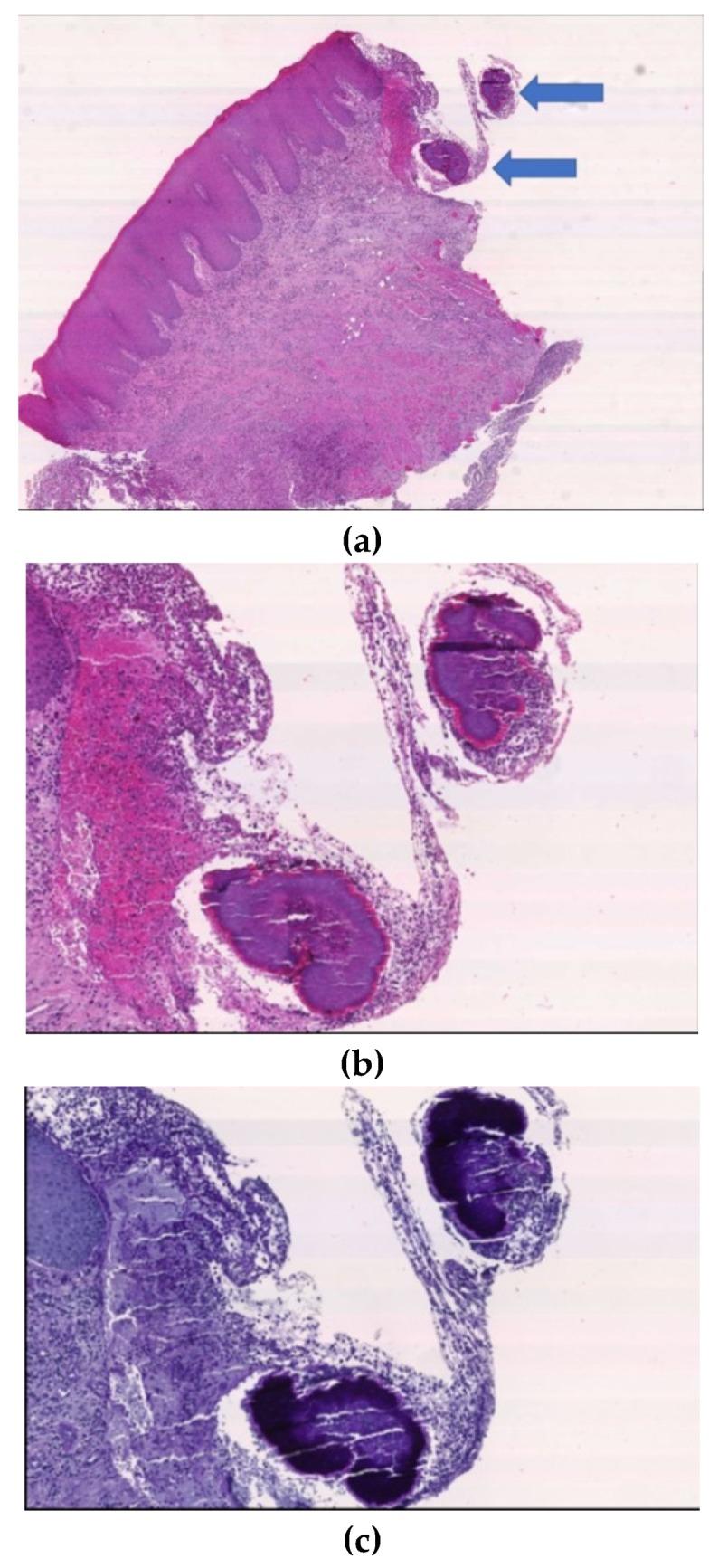https://cdn.ncbi.nlm.nih.gov/pmc/blobs/6fc5/7148533/12da8c555e7e/antibiotics-09-00124-g003.jpg