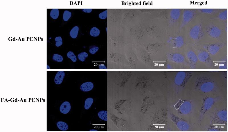 https://cdn.ncbi.nlm.nih.gov/pmc/blobs/6fc9/6058675/a941a07818a3/IDRD_A_1422299_F0003_C.jpg