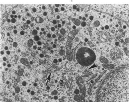https://cdn.ncbi.nlm.nih.gov/pmc/blobs/6fd2/2032513/8fc4f2bdc516/amjpathol00451-0165-b.jpg