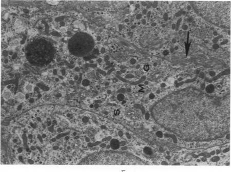 https://cdn.ncbi.nlm.nih.gov/pmc/blobs/6fd2/2032513/a10bf3924668/amjpathol00451-0165-a.jpg