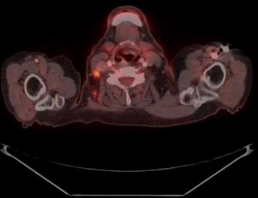 https://cdn.ncbi.nlm.nih.gov/pmc/blobs/6fdf/1896163/febcc3d479ad/1477-7819-5-65-2.jpg