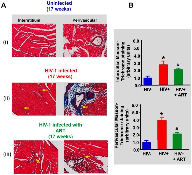 https://cdn.ncbi.nlm.nih.gov/pmc/blobs/6fe3/12027674/2a6f32a7313a/ijms-26-03801-g008.jpg