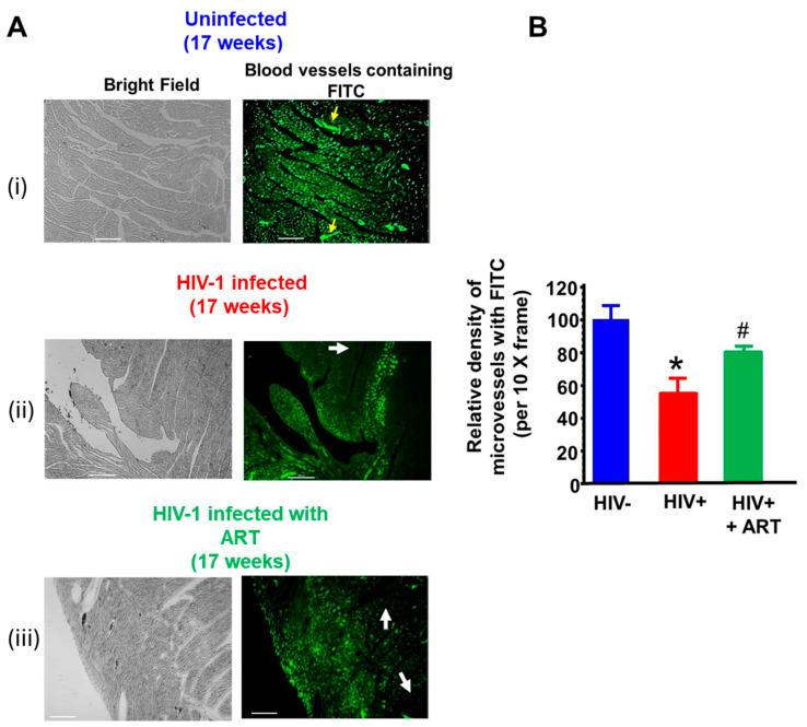 https://cdn.ncbi.nlm.nih.gov/pmc/blobs/6fe3/12027674/4603c5739373/ijms-26-03801-g007.jpg