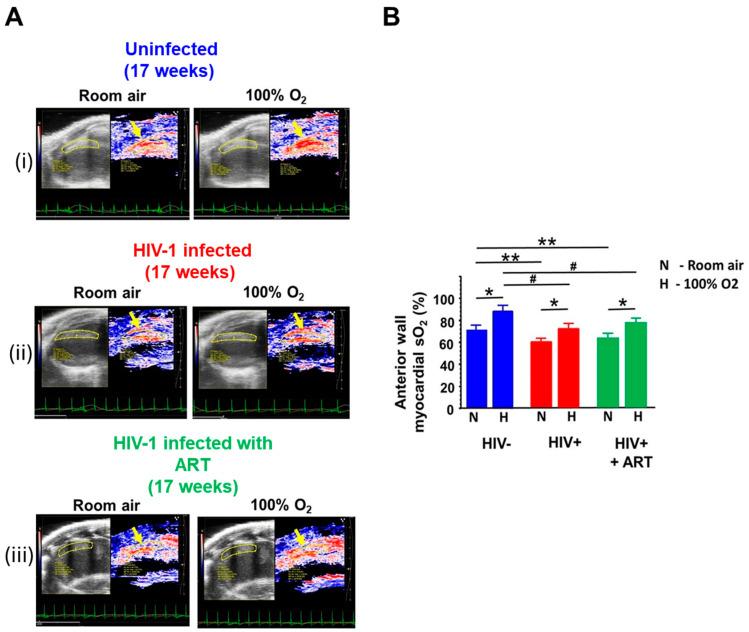 https://cdn.ncbi.nlm.nih.gov/pmc/blobs/6fe3/12027674/a06e0ce27e40/ijms-26-03801-g006.jpg
