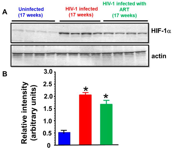 https://cdn.ncbi.nlm.nih.gov/pmc/blobs/6fe3/12027674/ffb98060f47c/ijms-26-03801-g009.jpg