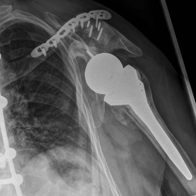 https://cdn.ncbi.nlm.nih.gov/pmc/blobs/6fe3/8894215/b10439d8afd8/132_2021_4205_Fig5_HTML.jpg