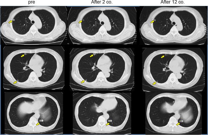 https://cdn.ncbi.nlm.nih.gov/pmc/blobs/6fed/11028776/7658739c5766/262_2016_1915_Fig1_HTML.jpg