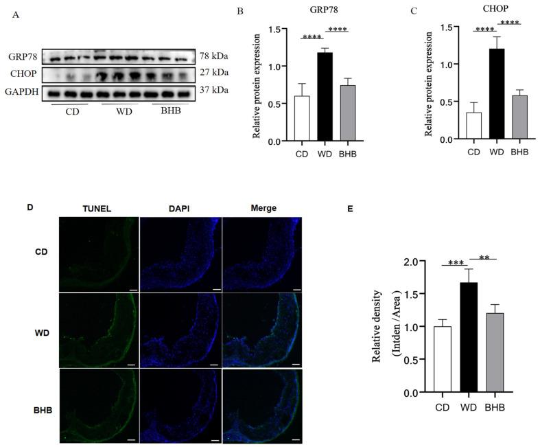 https://cdn.ncbi.nlm.nih.gov/pmc/blobs/6fee/11722964/b7294ee912b5/nutrients-17-00111-g004.jpg