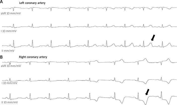 https://cdn.ncbi.nlm.nih.gov/pmc/blobs/6ff2/6727230/e9a2397b7059/PWKI-15-86007-g001.jpg