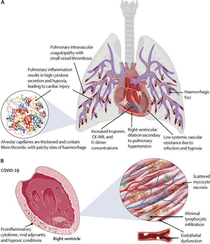 https://cdn.ncbi.nlm.nih.gov/pmc/blobs/6ff7/7255150/958eaf789aa4/gr1_lrg.jpg