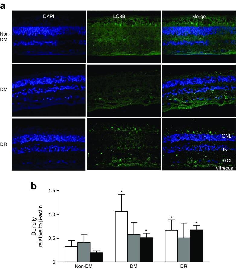 https://cdn.ncbi.nlm.nih.gov/pmc/blobs/6ff8/5016562/ec797e3ba67b/125_2016_4058_Fig1_HTML.jpg