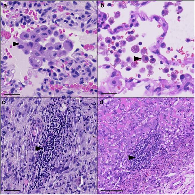 https://cdn.ncbi.nlm.nih.gov/pmc/blobs/6ffd/12081698/b3db8421c0d5/42003_2025_7992_Fig3_HTML.jpg