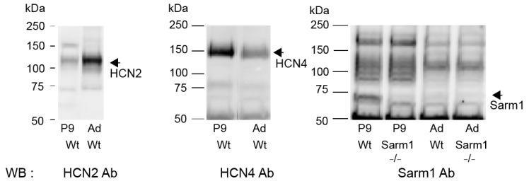 https://cdn.ncbi.nlm.nih.gov/pmc/blobs/6ffe/11172389/6fb82b0e8590/cells-13-00944-g006.jpg