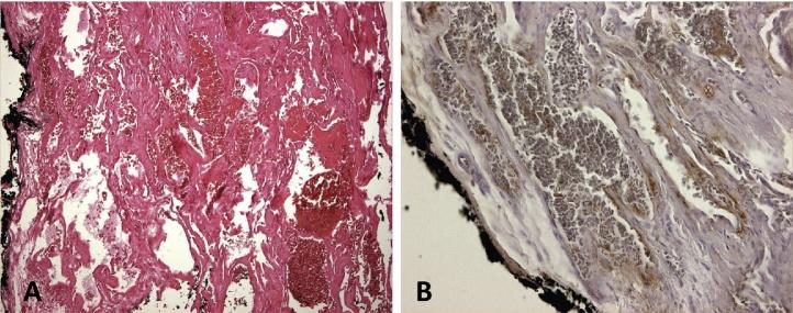 https://cdn.ncbi.nlm.nih.gov/pmc/blobs/6ffe/5384294/a22d8b2c5ce7/gr4.jpg