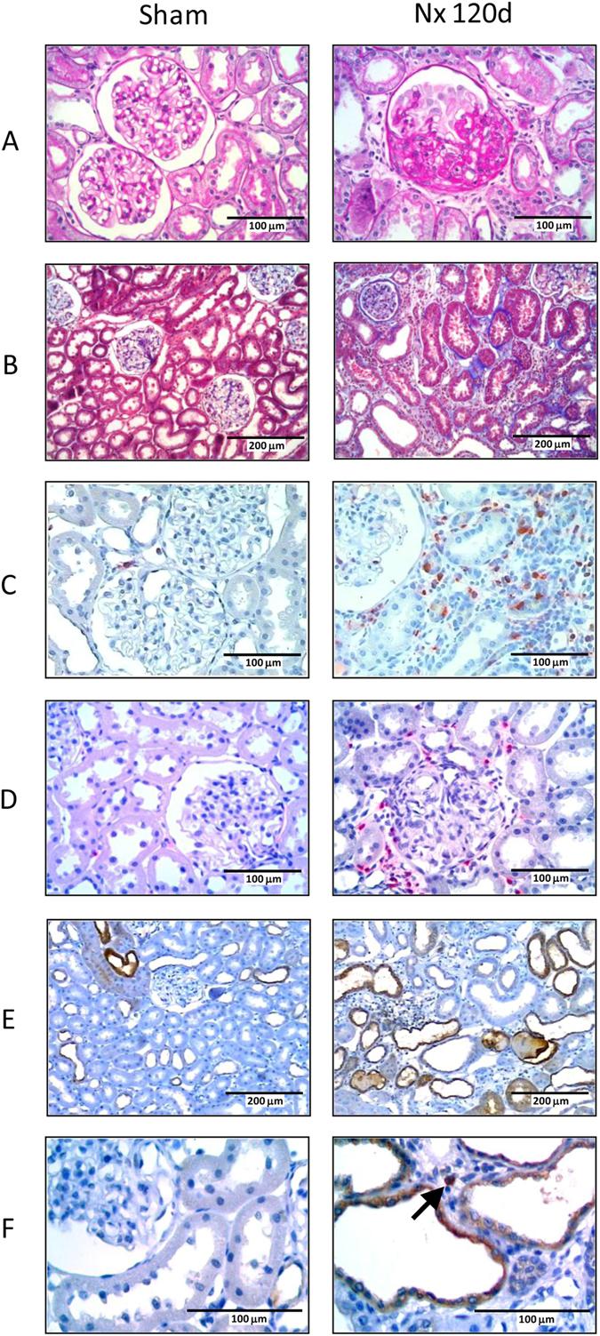 https://cdn.ncbi.nlm.nih.gov/pmc/blobs/7005/5466605/7e1841547b84/41598_2017_2915_Fig1_HTML.jpg