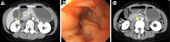 https://cdn.ncbi.nlm.nih.gov/pmc/blobs/7006/10749823/ff8d462f37e0/1349-7235-62-3479-g001.jpg