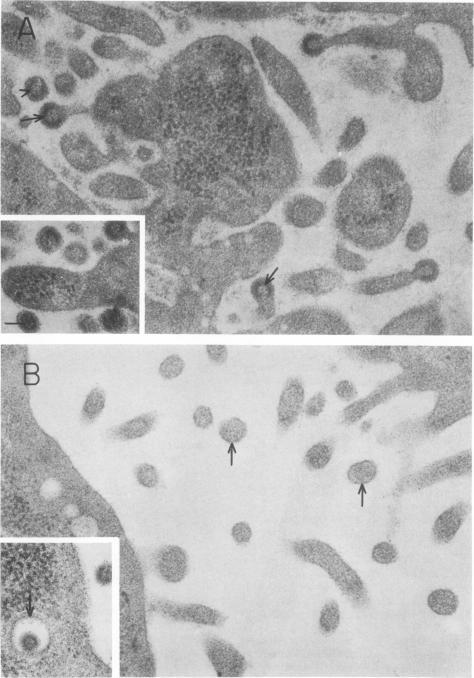 https://cdn.ncbi.nlm.nih.gov/pmc/blobs/701d/355610/a27669fda7f4/jvirol00250-0324-a.jpg