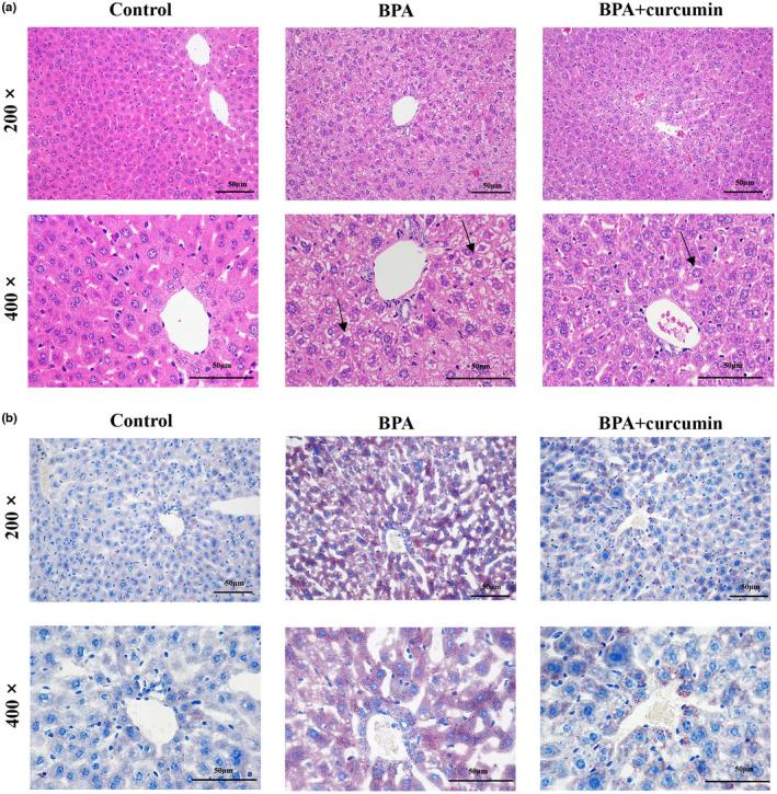 https://cdn.ncbi.nlm.nih.gov/pmc/blobs/7023/10494624/b3f6338b6422/FSN3-11-5091-g001.jpg