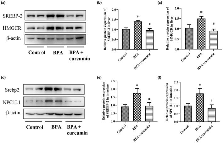 https://cdn.ncbi.nlm.nih.gov/pmc/blobs/7023/10494624/c8fe216a2c1c/FSN3-11-5091-g003.jpg